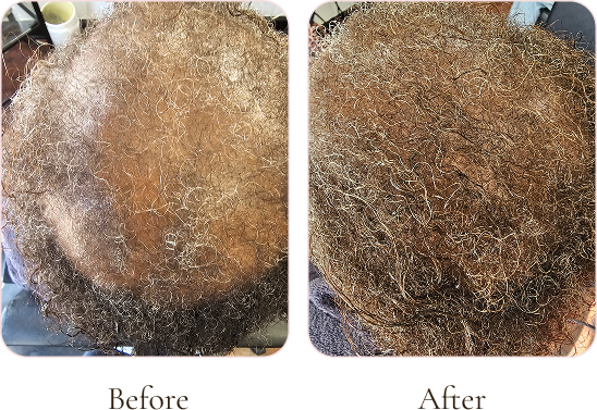 Before and after images showing a person's curly gray hair, with the second image depicting improved texture after styling or treatment.