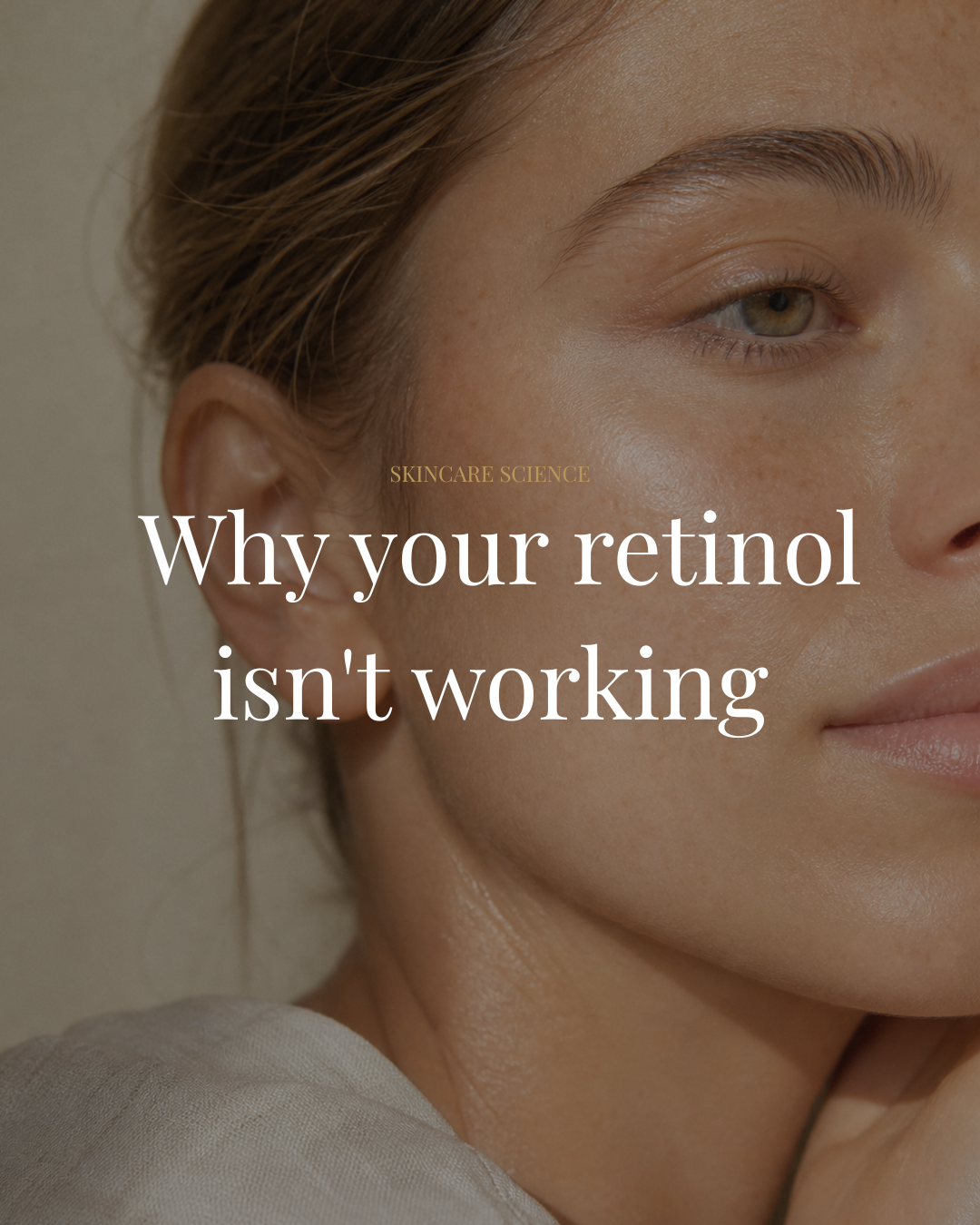 Why your retinol isn't working — and what actually will