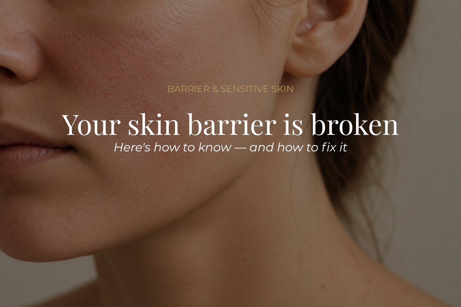 Your skin barrier is broken — here's how to know and how to fix it