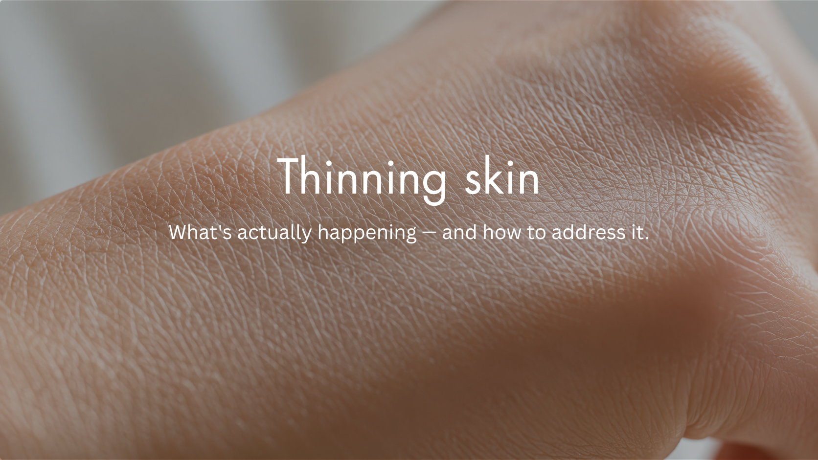 Thinning Skin: Why It Happens and What Prescription Treatment Can Do