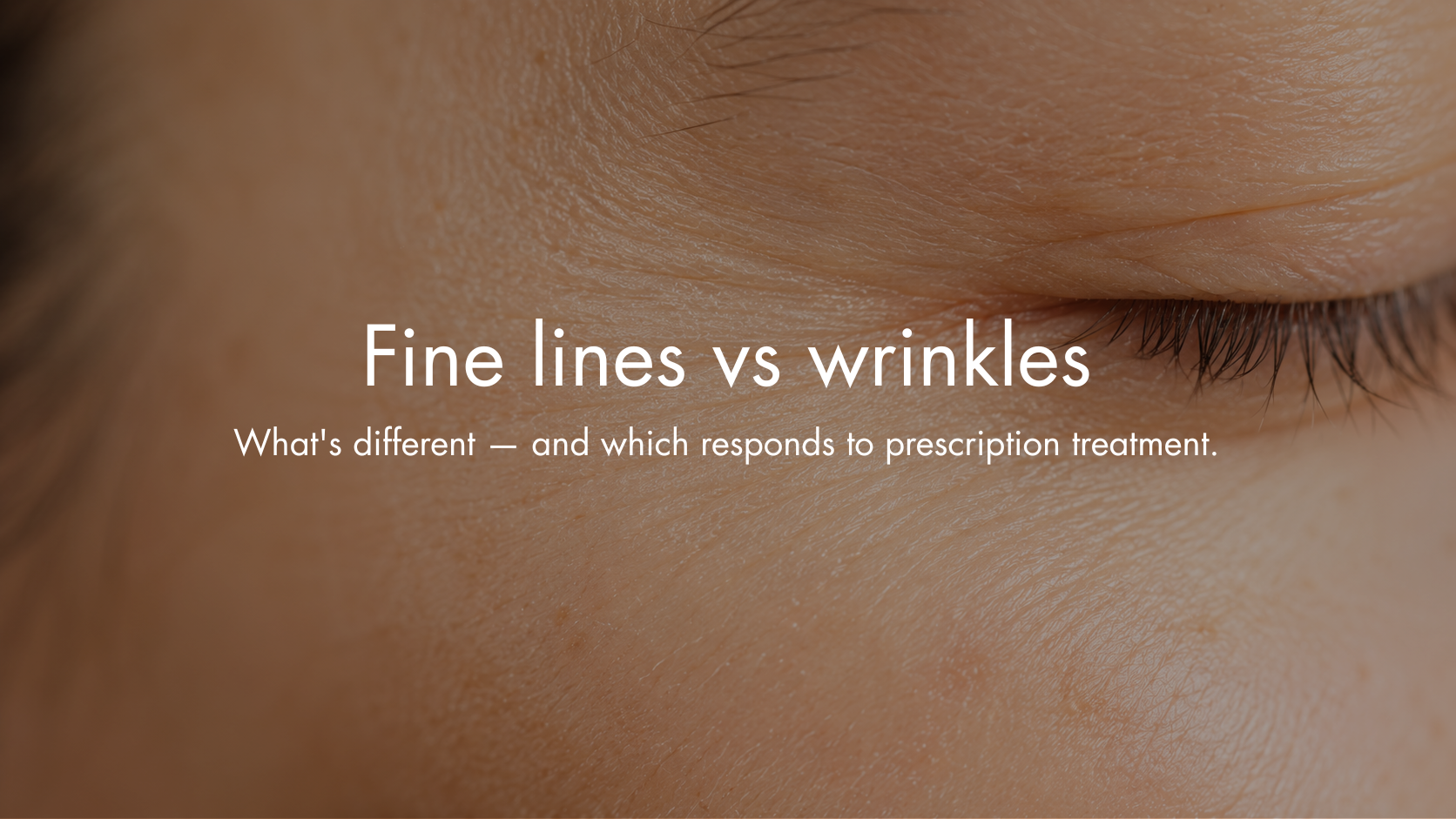 Fine Lines vs Wrinkles: What's the Difference — and Which Responds to Prescription Treatment?