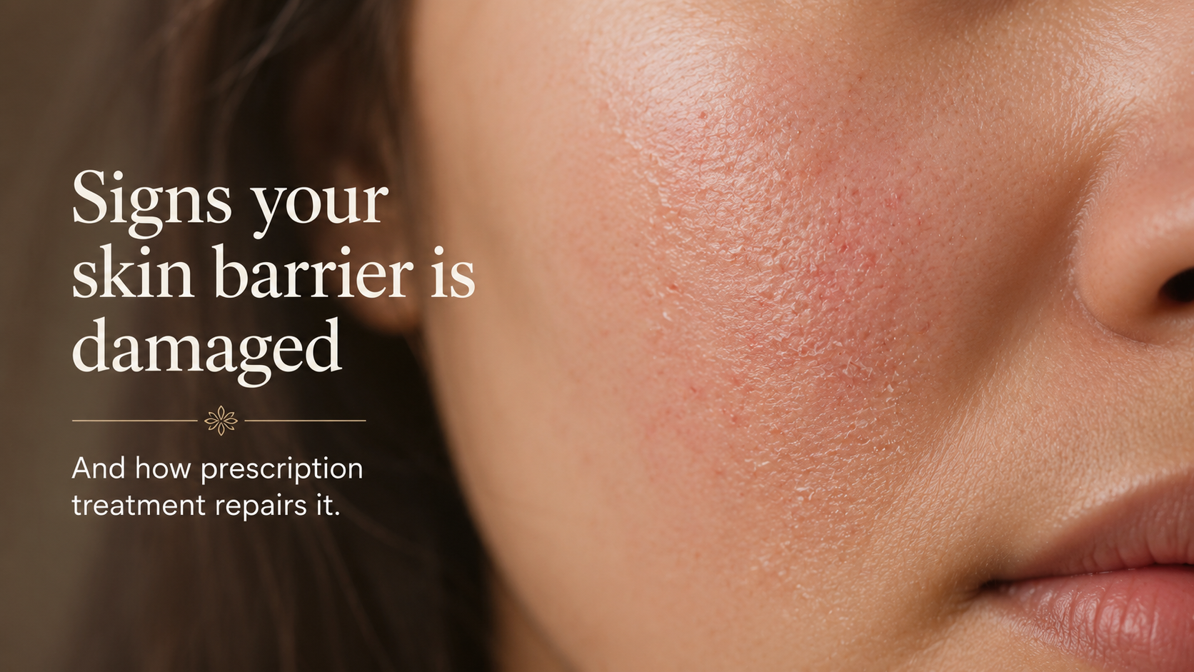 Signs Your Skin Barrier Is Damaged — and How Prescription Treatment Repairs It