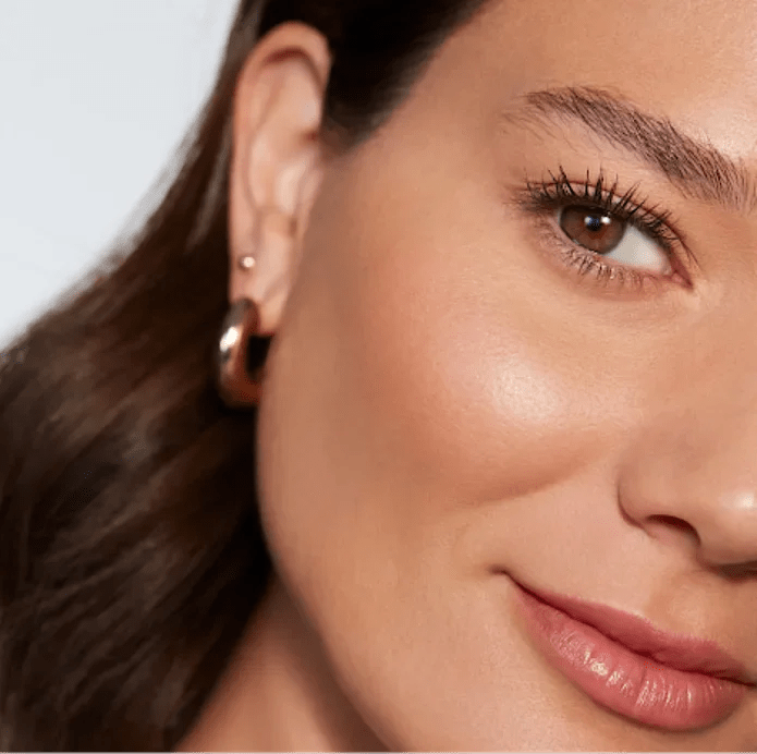 Juvederm Voluma cheek augmentation results showing restored midface volume
