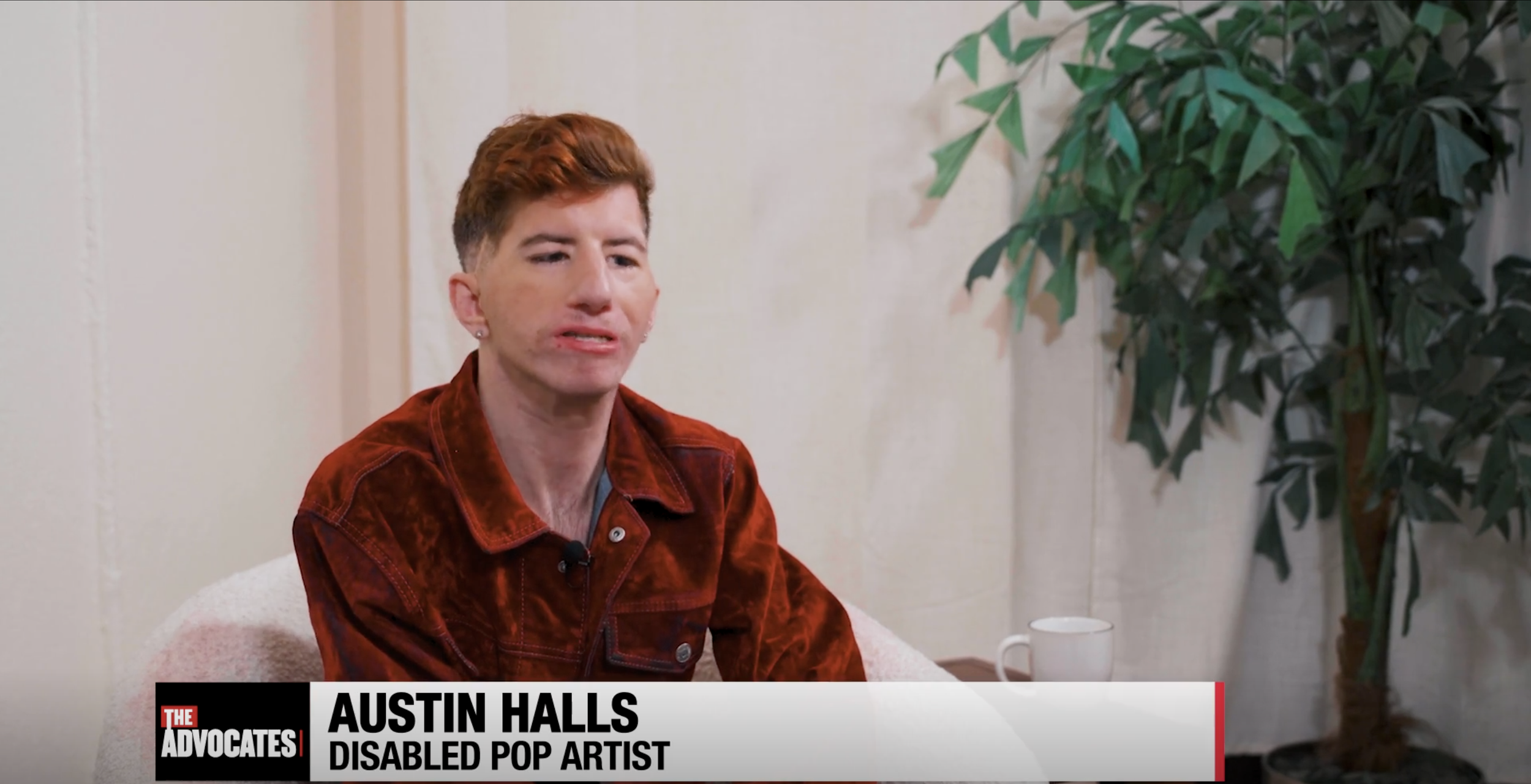 Disabled Pop Artist, Austin Halls
