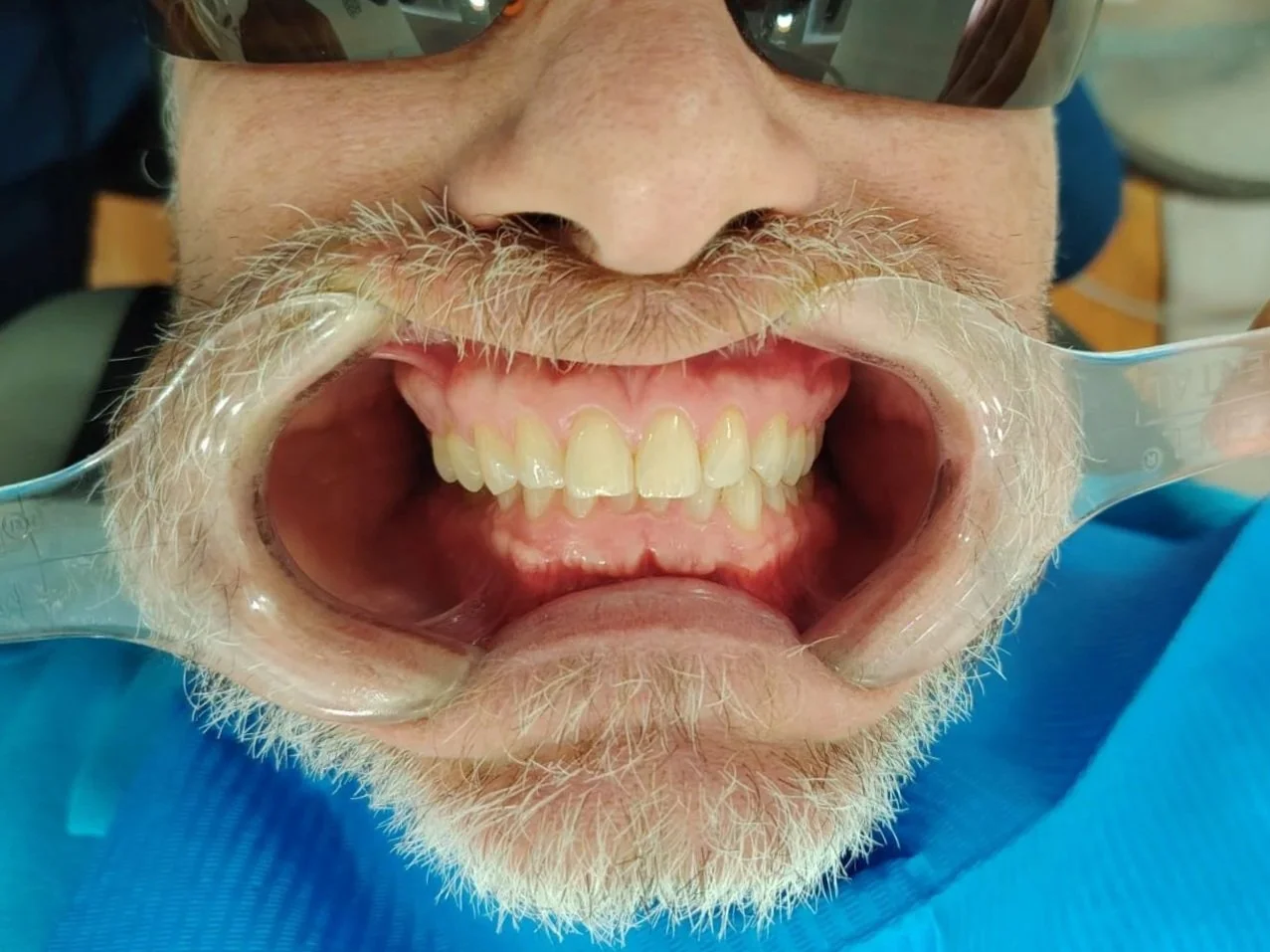 Dental exam at Dental Playa in Playa del Carmen.