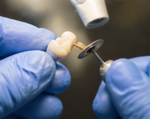 A dental technician using a drill to work on a dental prosthetic or crown.