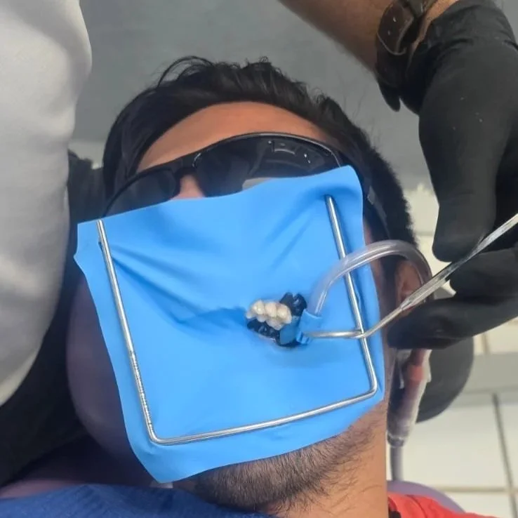 A person receiving dental treatment, with a blue dental bib, dental tools, and a suction tube in a dental office.