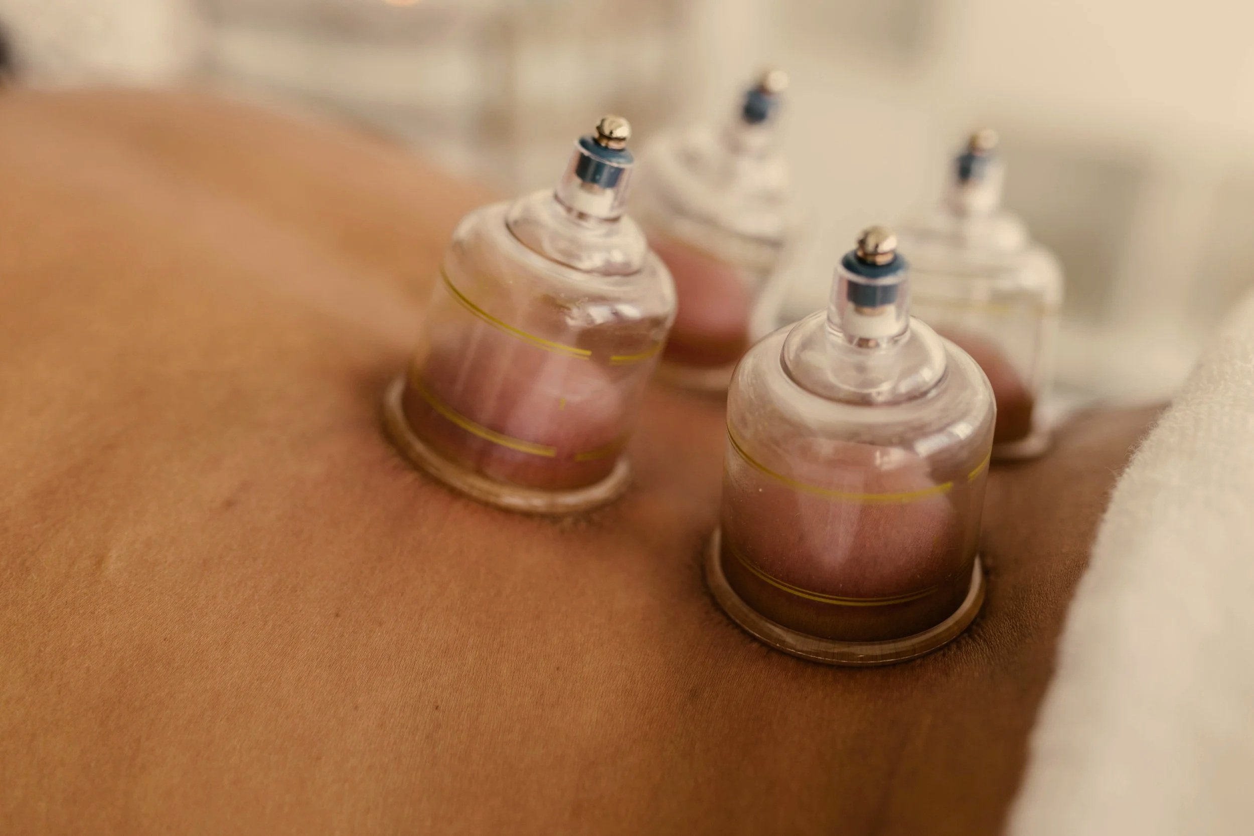 Vacuum Cupping Massage in Whitehall, MT