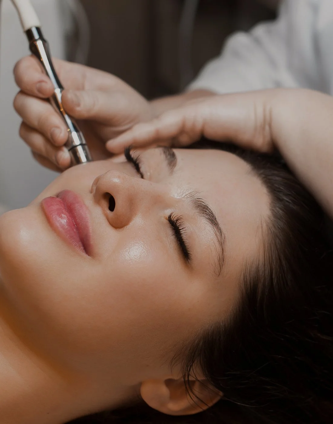 Microneedling