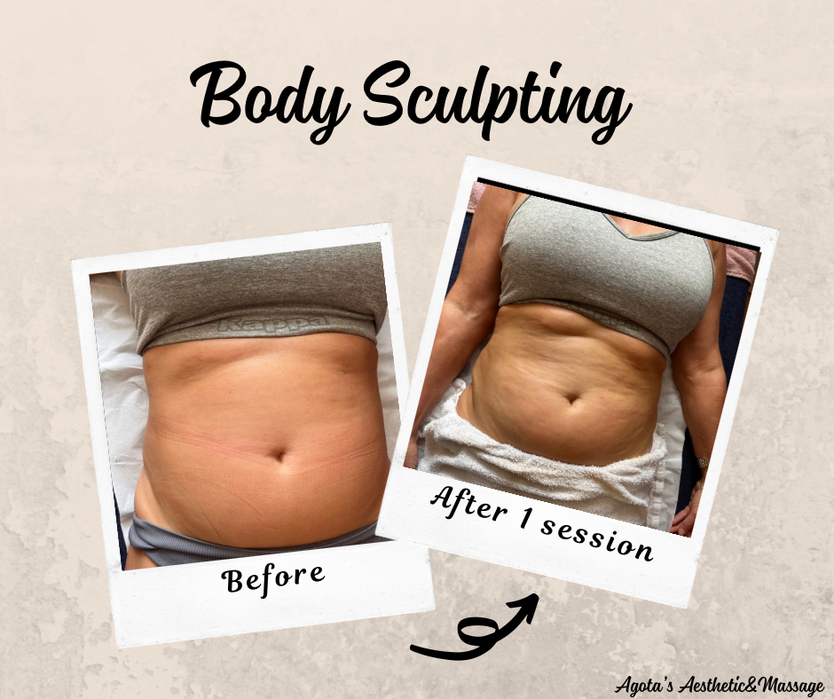 Beige Simple Before After Facebook Post.png