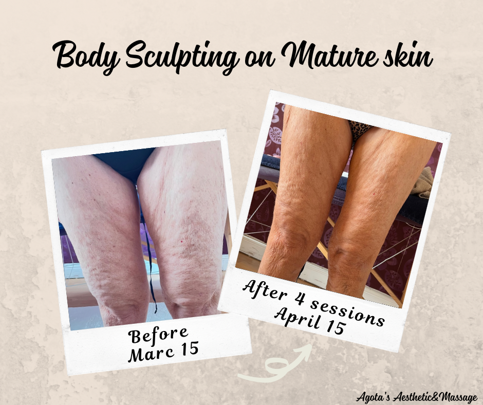 Beige Simple Before After Facebook Post.png