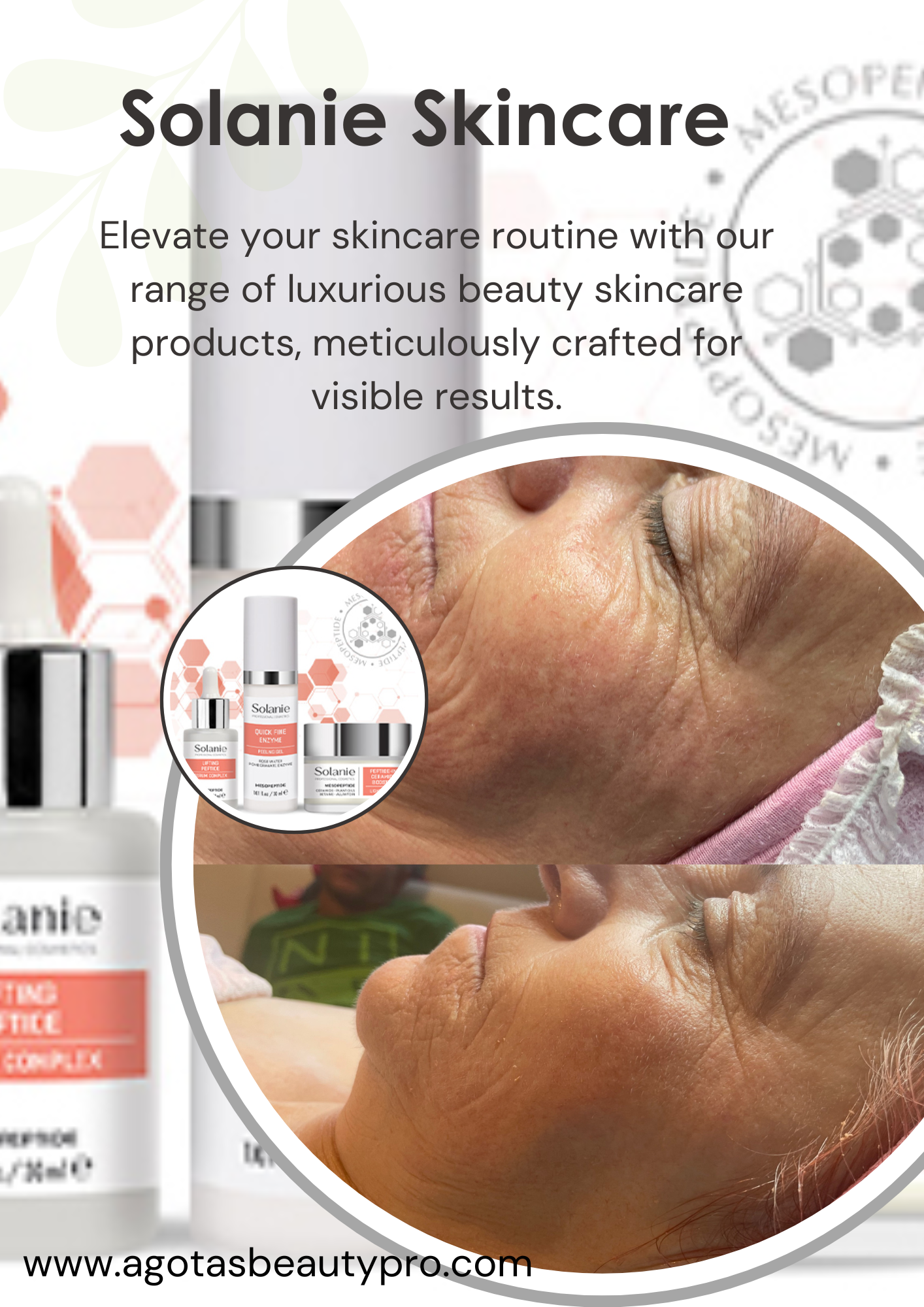 SOLANIE 3PEPTIDE NO NEEDLE MEZOTHERAPY