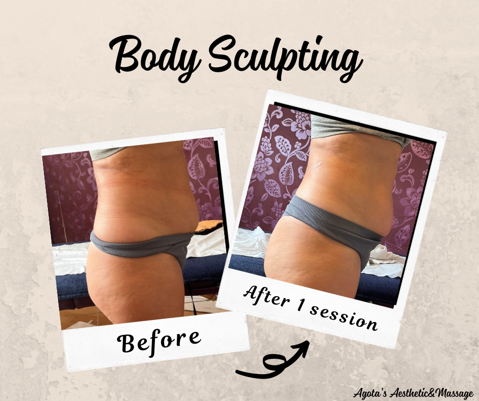 Beige Simple Before After Facebook Post.png