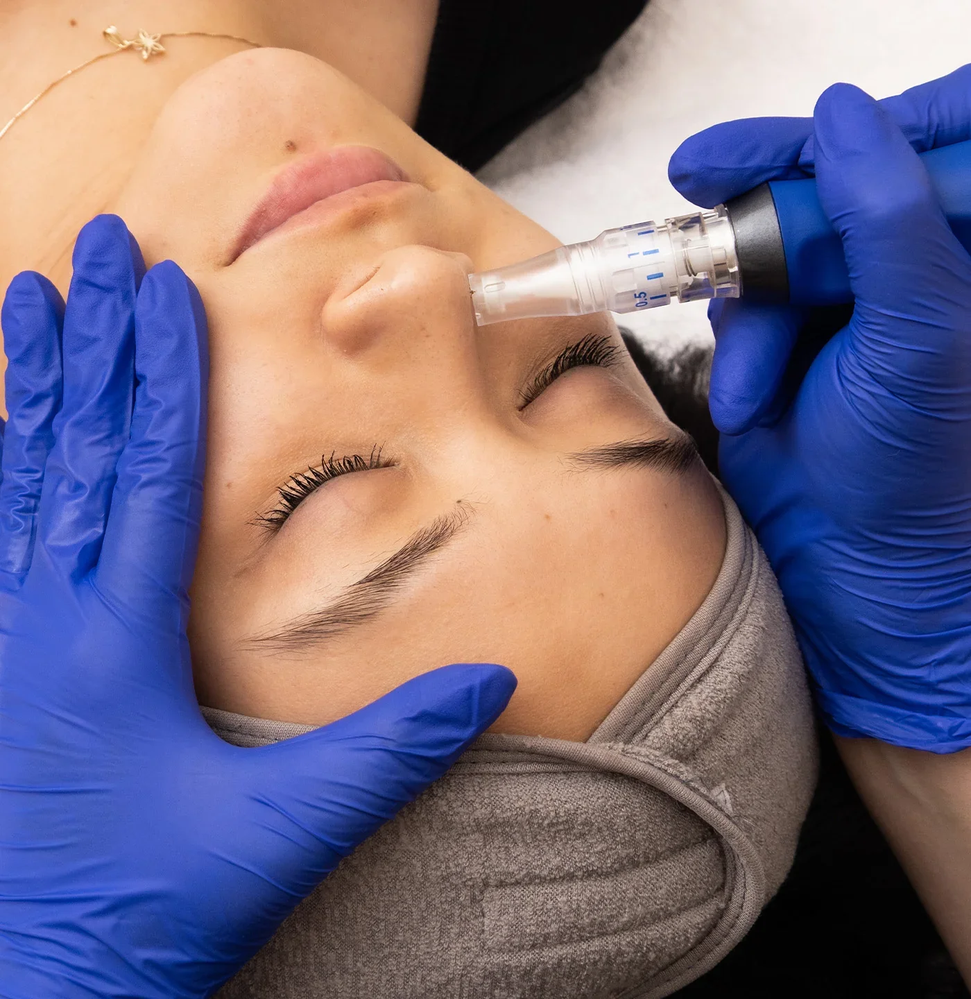 Microneedling & PRP