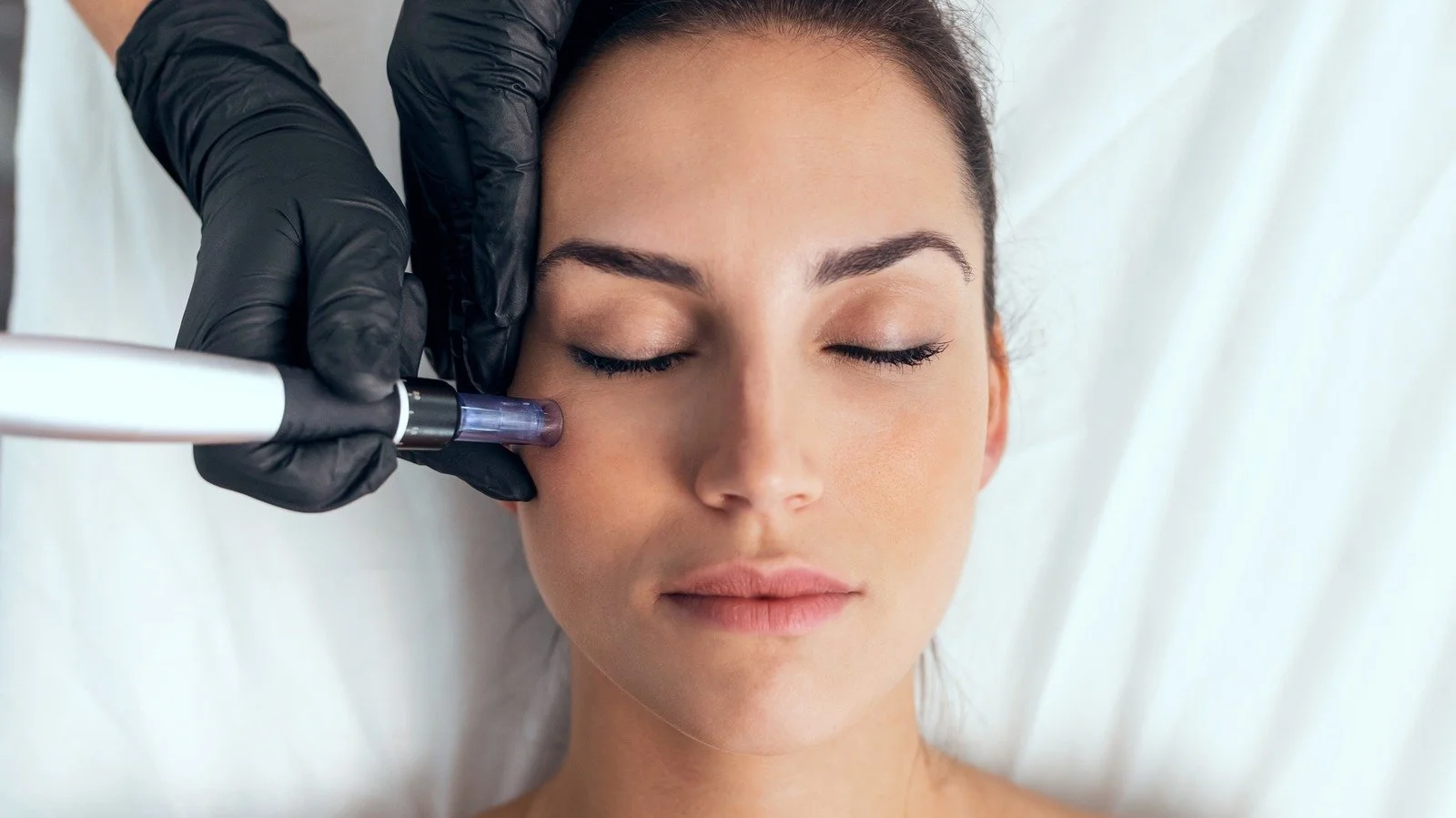 Woman receiving a cosmetic or medical treatment on her face with a handheld device, while lying down with eyes closed, in a clinical setting.
