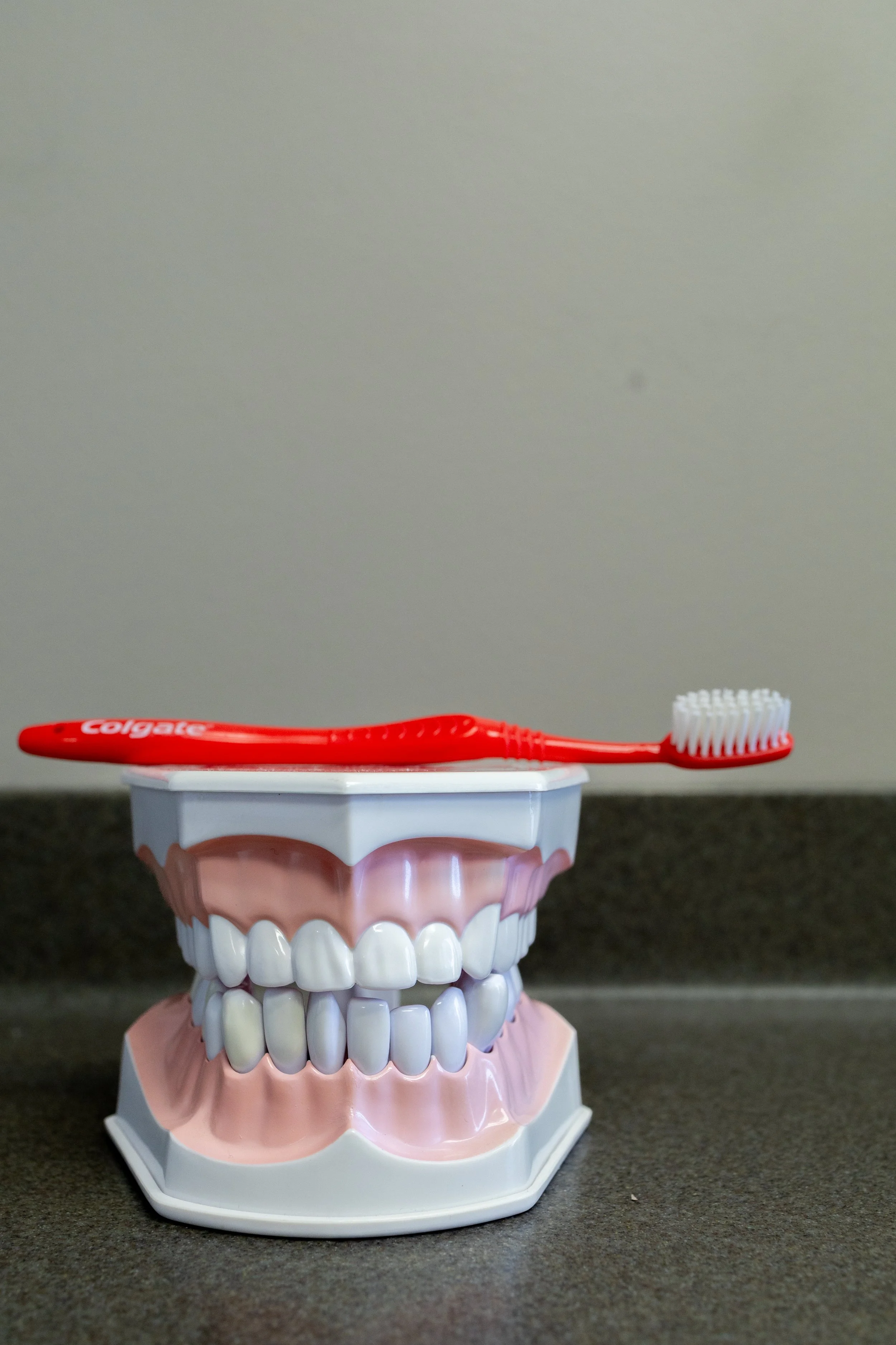 A red toothbrush resting on a model of teeth