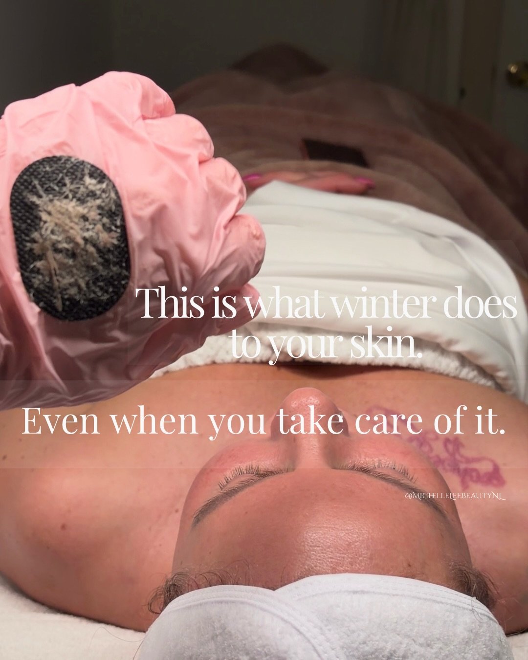 Does your skin feel dull, dry or just not quite itself coming out of winter? There is actually a biological reason for that and it is not just in your head.

Your skin has its own natural renewal cycle. New cells are constantly being produced and old
