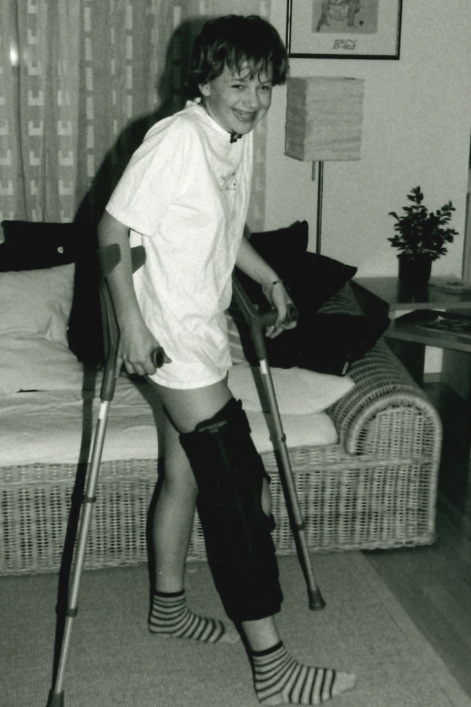 A young girl smiling with crutches, wearing a knee brace and striped socks, in a living room setting with a couch, table, and art on the wall.
