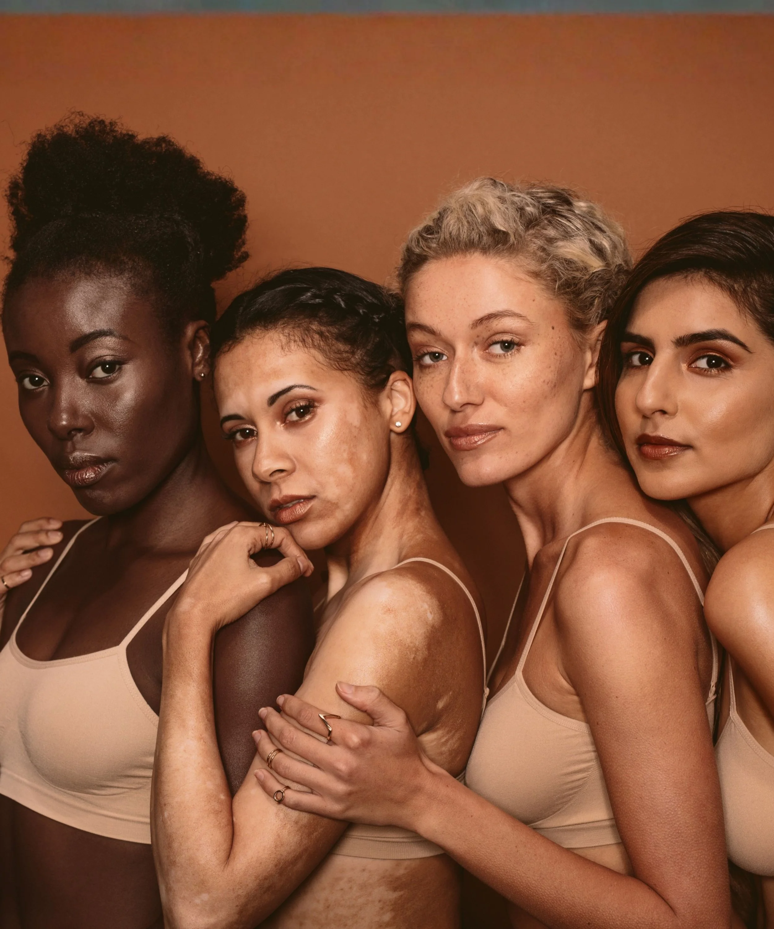 Four women of diverse ethnicities standing closely together, showing their skin with various skin conditions, against a warm brown background.