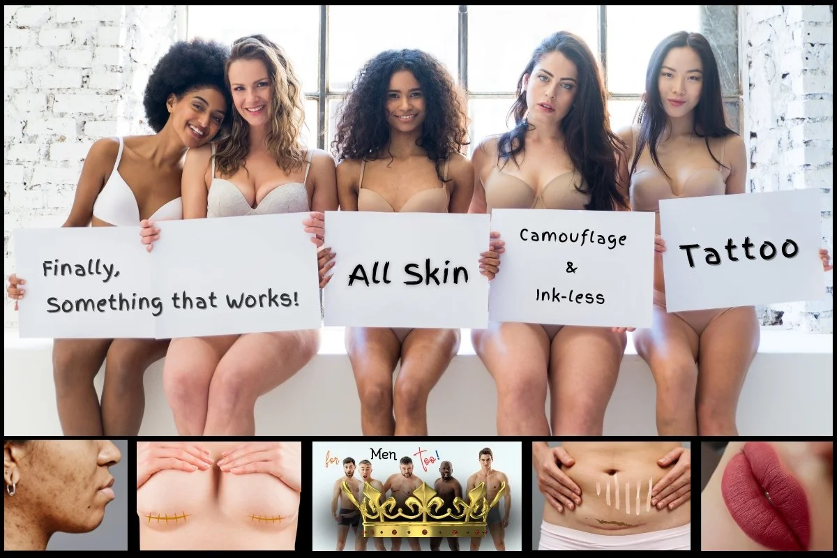 cypress aesthetics camouflage and inkless tattoo for scars, stretch marks, acne, hairless, #1. permanent make-up, Smp, scar treatments.