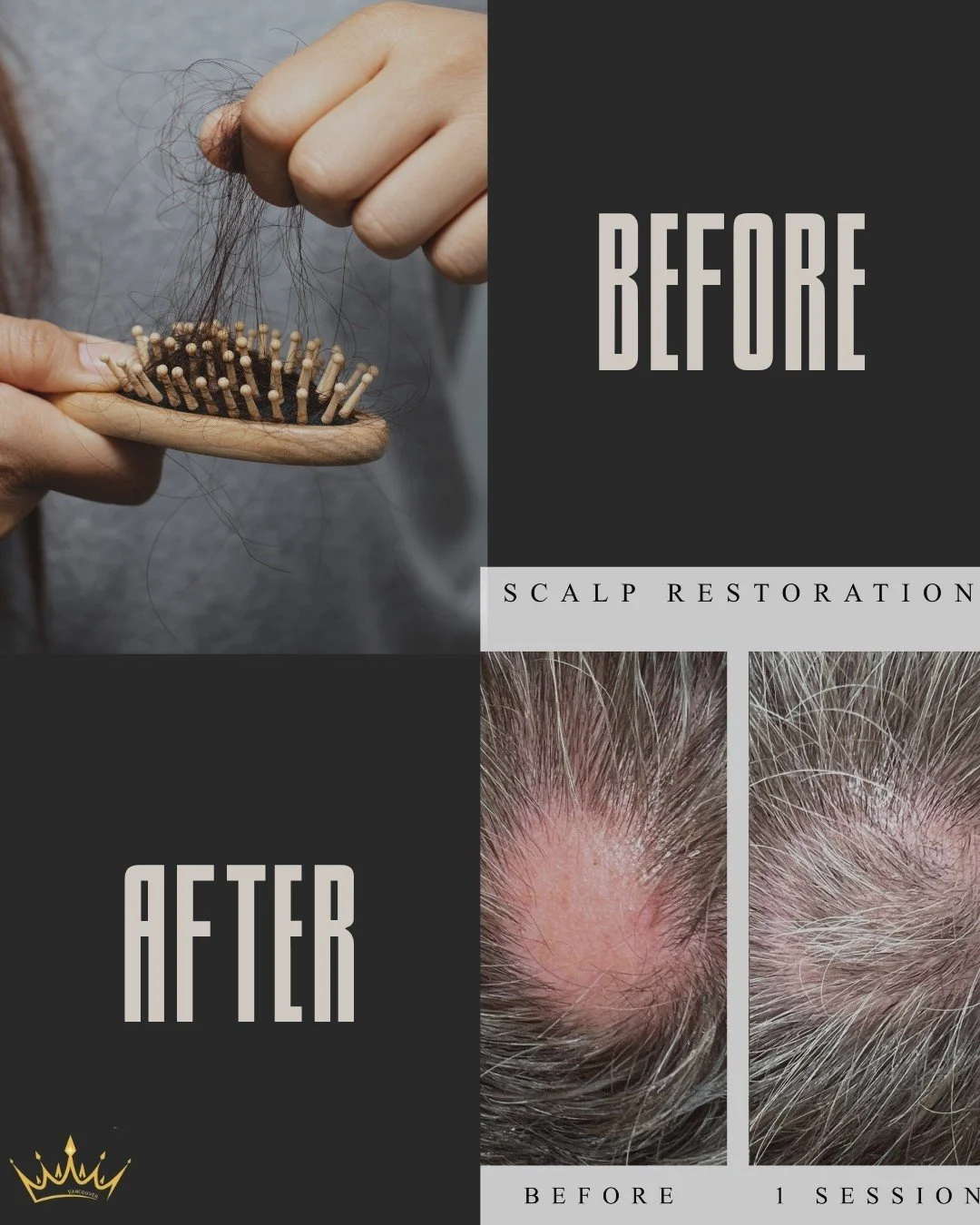 Before you jet off to Turkey for those hair plugs, why not check out what's brewing right in your own city? 🌍💥 Hit up 778-985-SKiN (7546) for a  consultation or snag a spot at bookskin.as.me
 &mdash;it's quick and easy! 

You will discover a local 