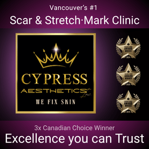 Advertisement for Cypress Aesthetics Scar and Stretch Mark Clinic with awards and slogan, in purple and black colors.