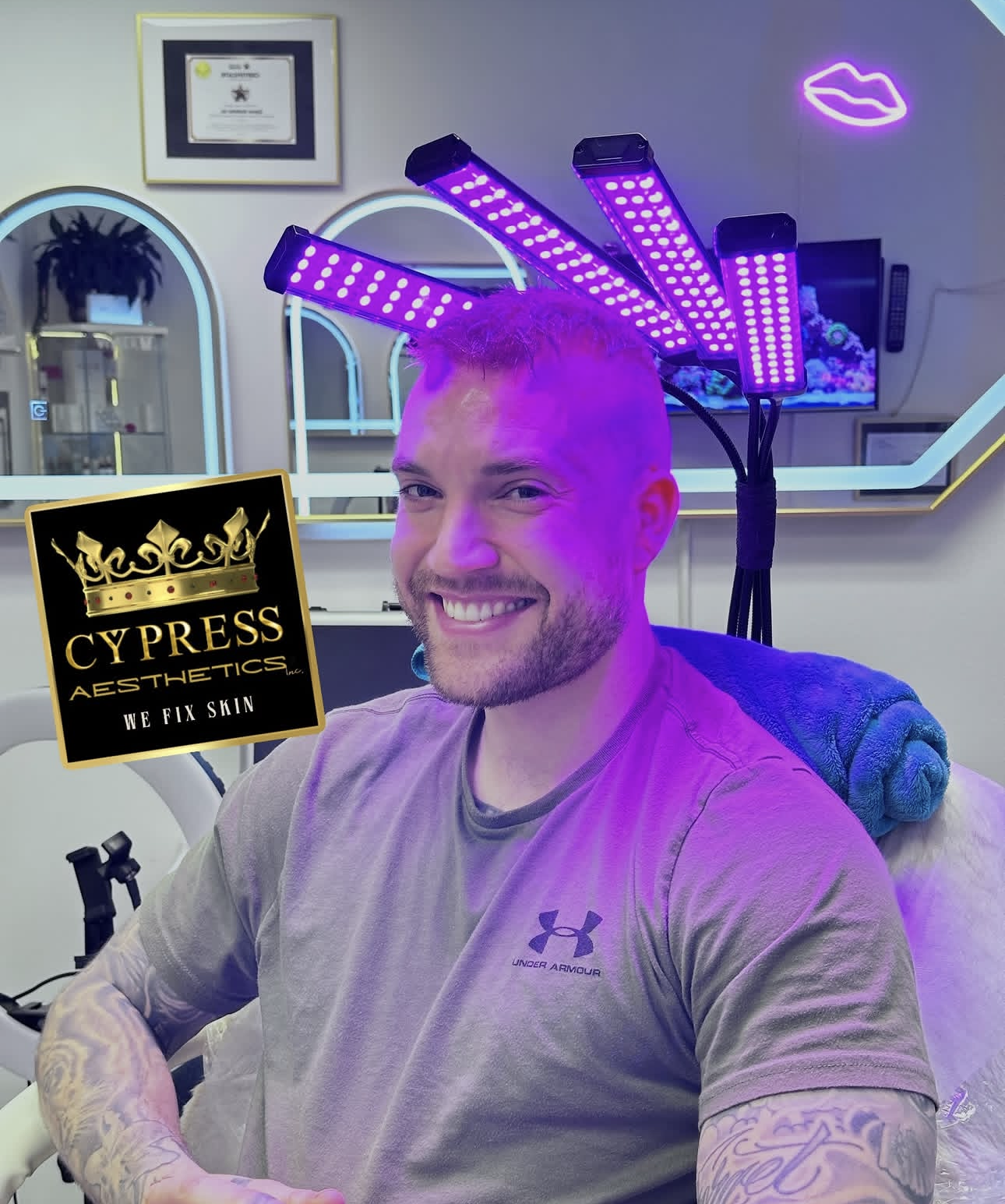 A smiling man with tattoos on his arm, wearing a beige shirt, seated in a clinic LED light therapy devices on his head, and a black and gold sign for Cypress Aesthetics Inc. that reads 'We Fix Skin'. After Hair-loss treatment.