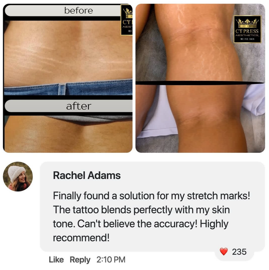 Side-by-side comparison of a person's back and shoulder before and after tattoo removal treatment, with a customer review praising the results of a tattoo camouflage or skin blending service.