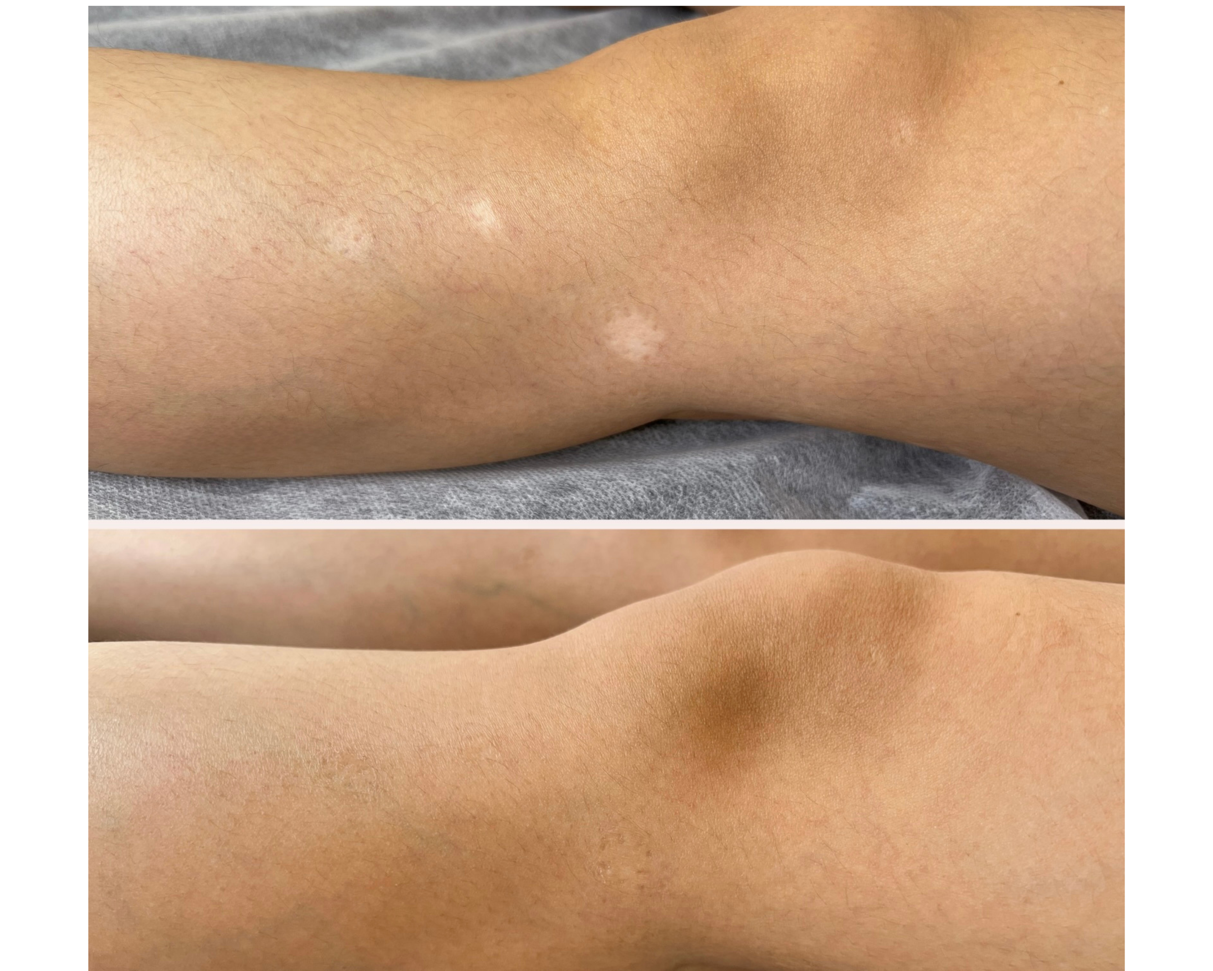Close-up images of skin, showing different textures and shades.