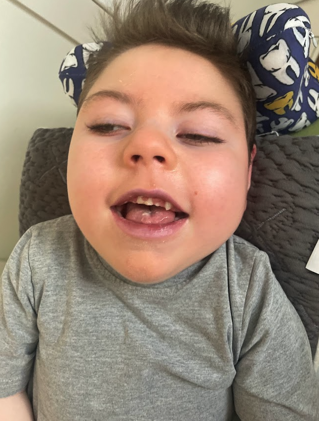 A young boy with short brown hair and light skin, smiling with his mouth slightly open, showing missing front teeth, in a gray shirt, lying on a bed with a dark brown pillow and a patterned pillow behind his head.