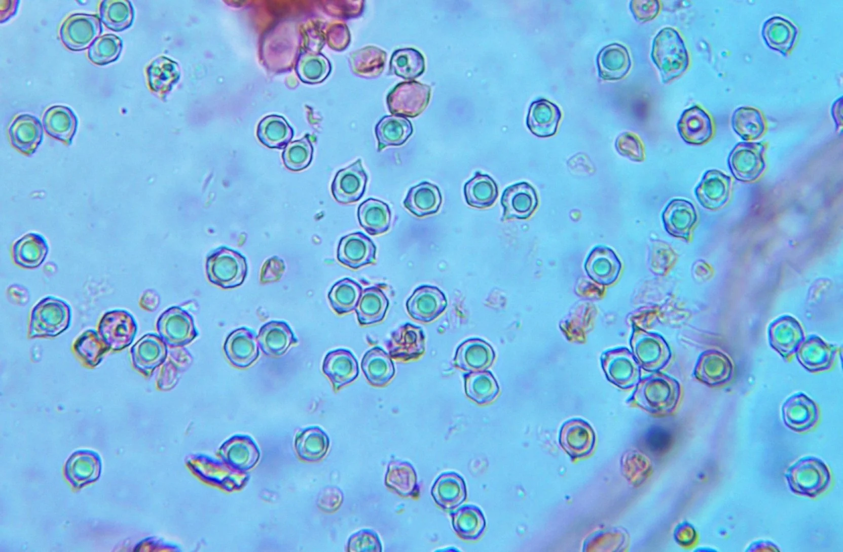 Microscopic view of Entoloma spores, a gilled mushroom, in lactophenol cotton blue.