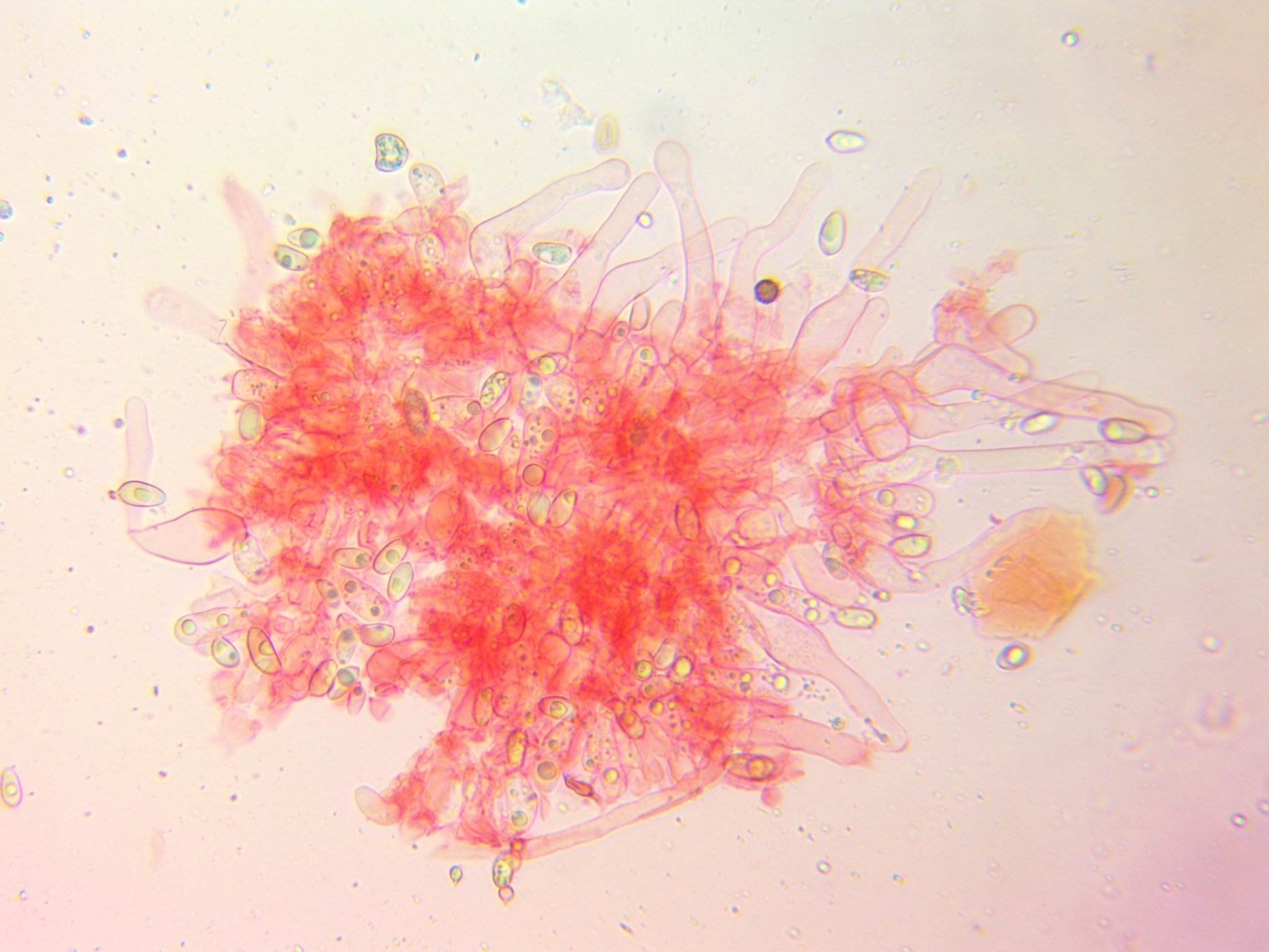 Microscopic view of Hebeloma alpinicola, a gilled mushroom, showing cheilocystidia.