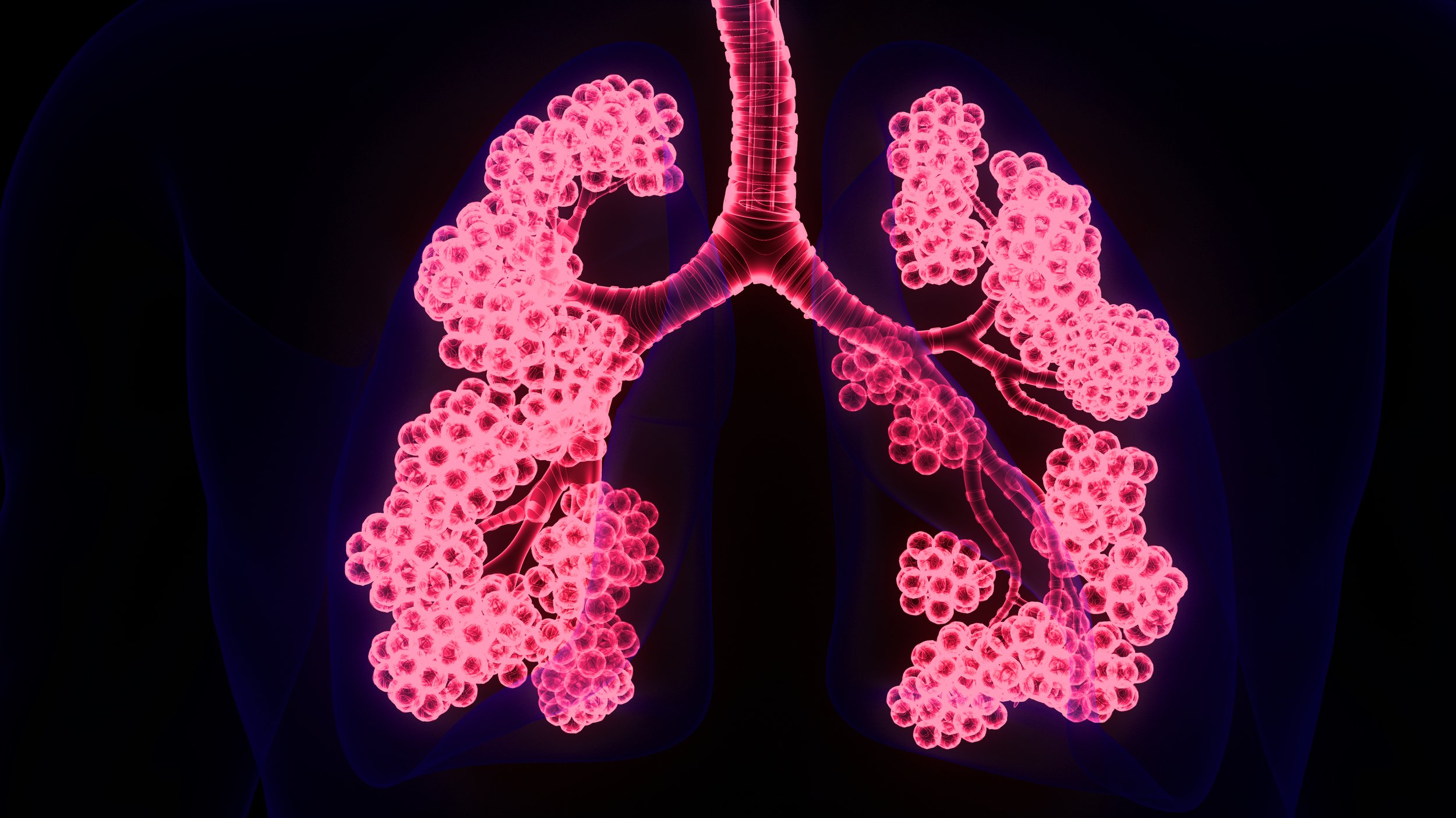Cystic fibrosis