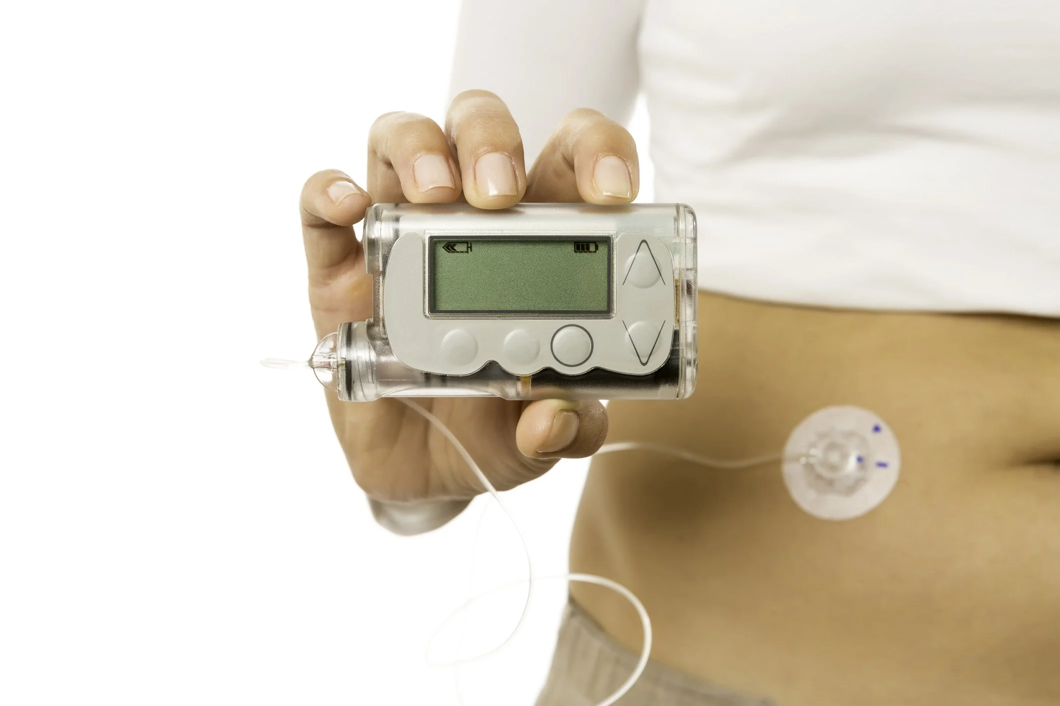 Glucose monitor