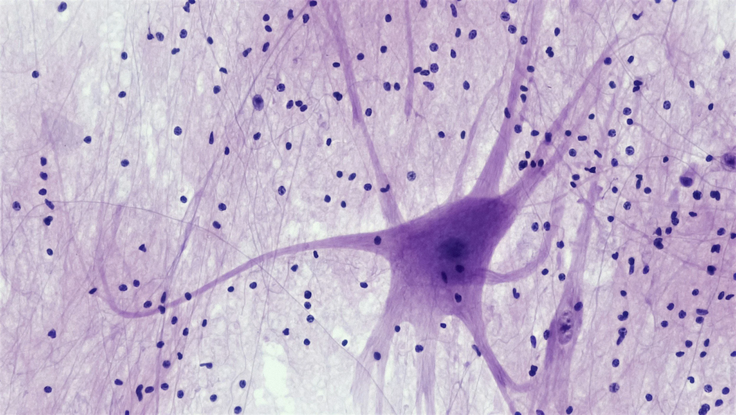 Microscopic view of neurons with purple cell bodies and numerous surrounding dark blue nuclei.