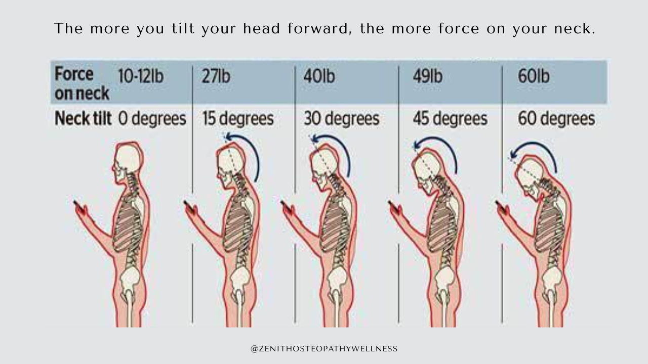 Is Your Posture Really that Important? What You Need To Know — ZENITH ...