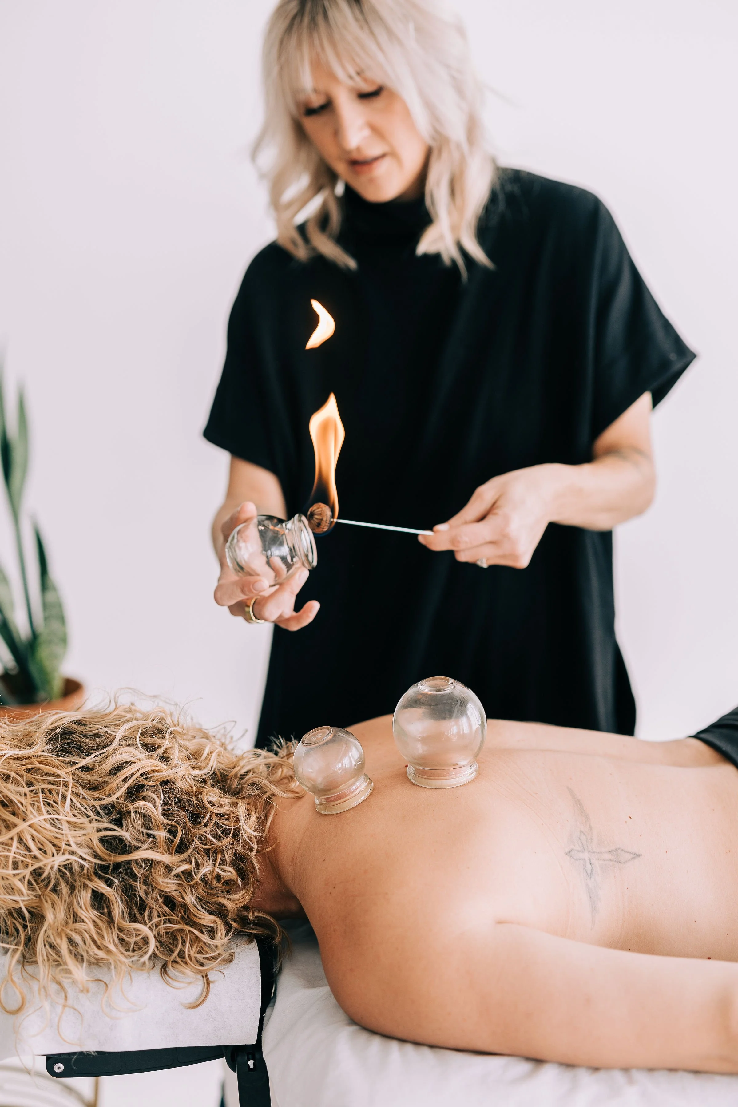 A woman with blonde curly hair receiving cupping therapy on her back in a clinical setting.