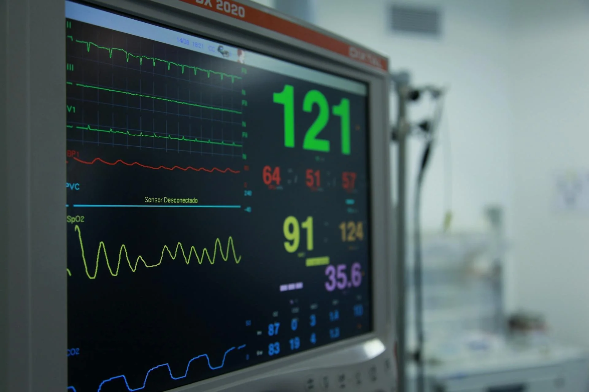 Results of a heart check on a screen