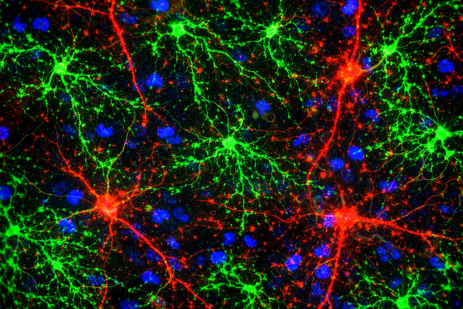 Colored microscopic image of neurons with green, red, and blue fluorescent staining, showing nerve cell bodies and network connections.