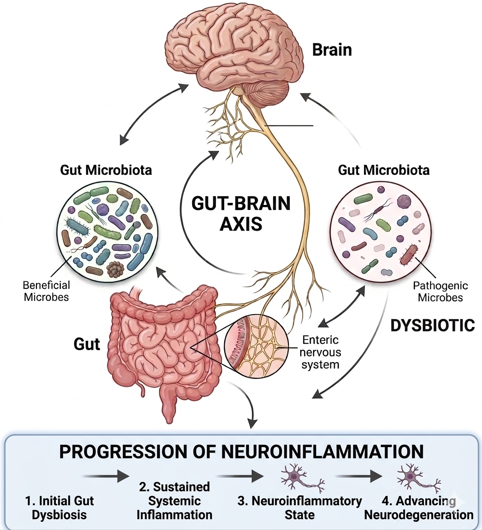 Diagram illustrating the gut-brain axis, showing the brain, gut, and enteric nervous system, with gut microbiota labeled as beneficial microbes and pathogenic microbes, and an infographic at the bottom showing progression of neuroinflammation stages.