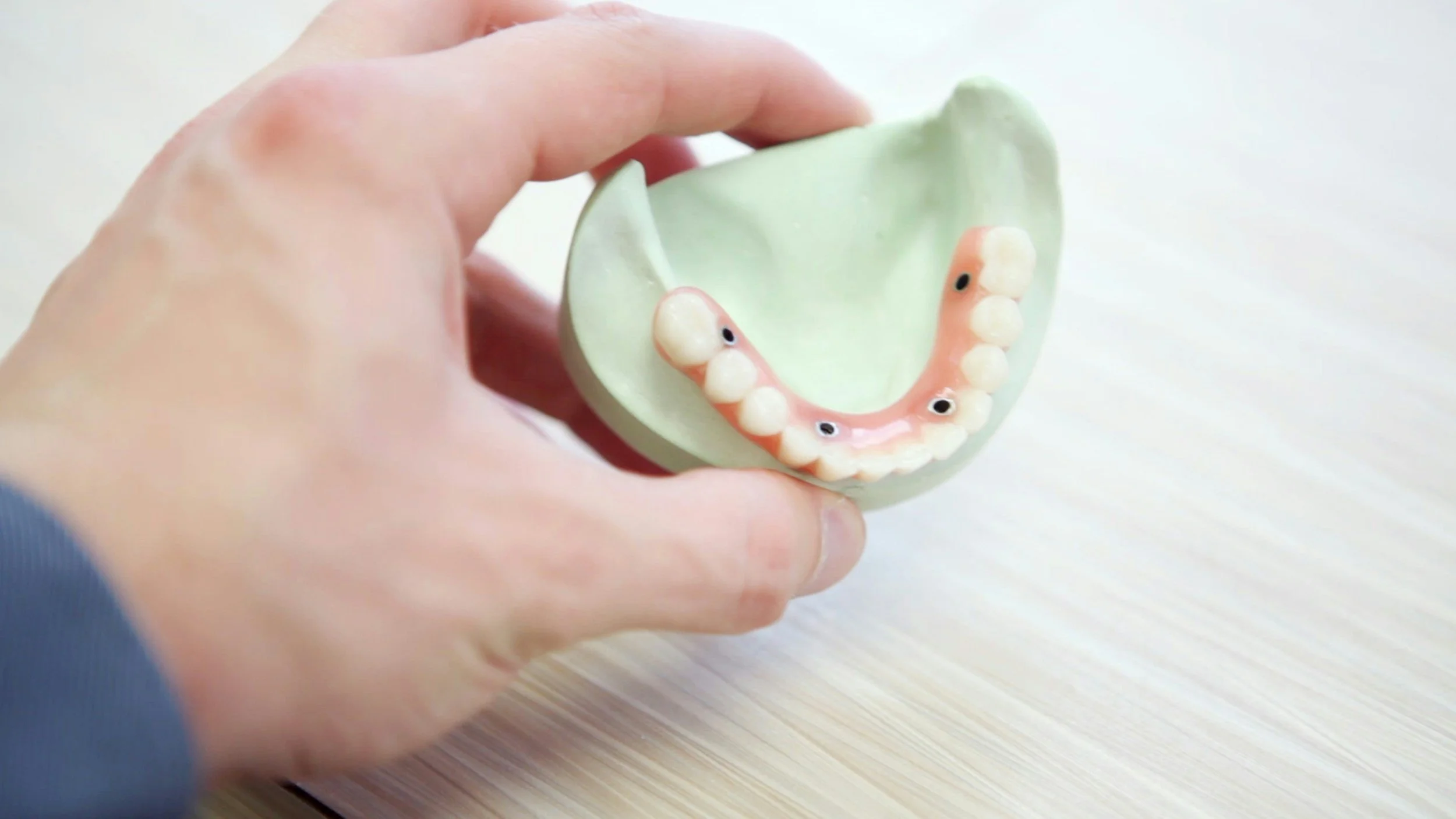 All-on-X implants