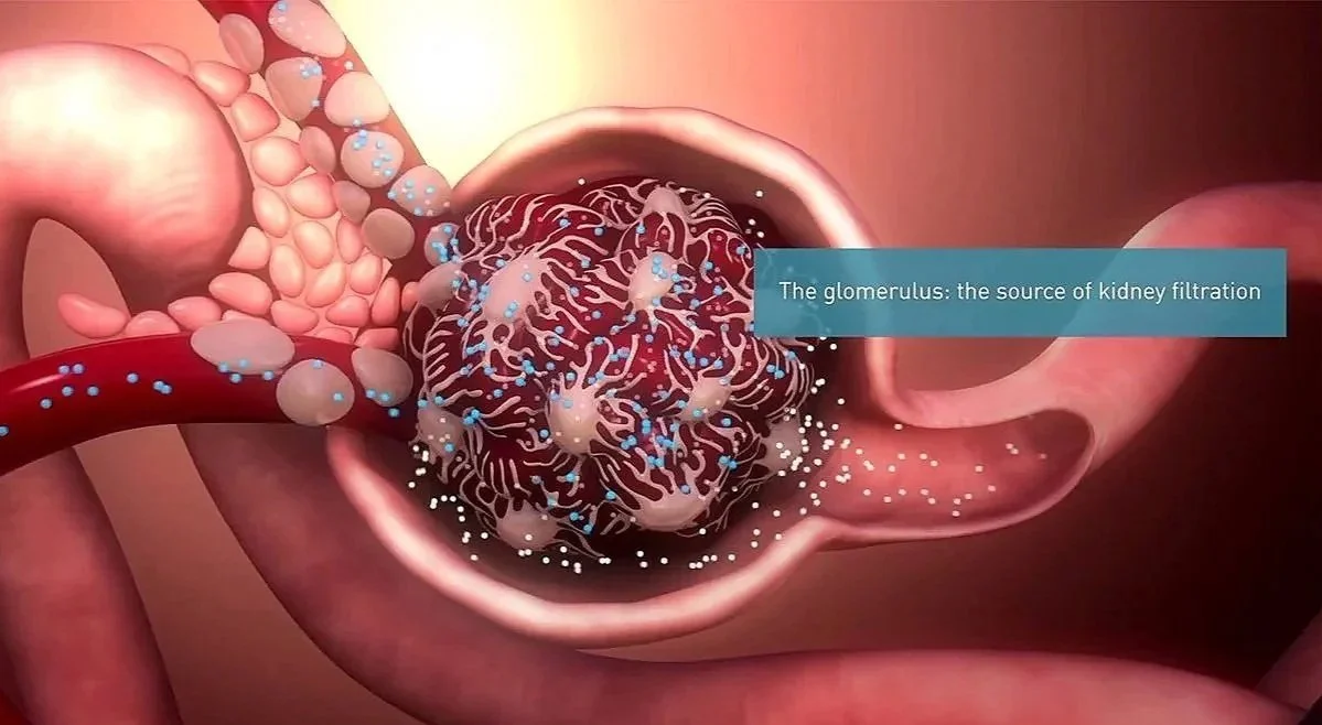 Diabetic CKD Source