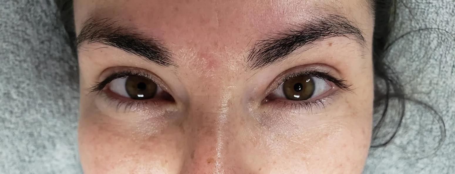 Close-up of a person's face focusing on their eyes without extensions and eyebrows.