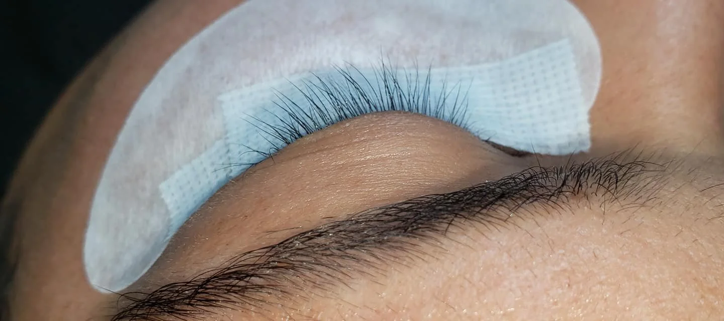 Close-up of a person's eye without eyelash extensions, with a protective eye patch and medical tape in a clinical setting.