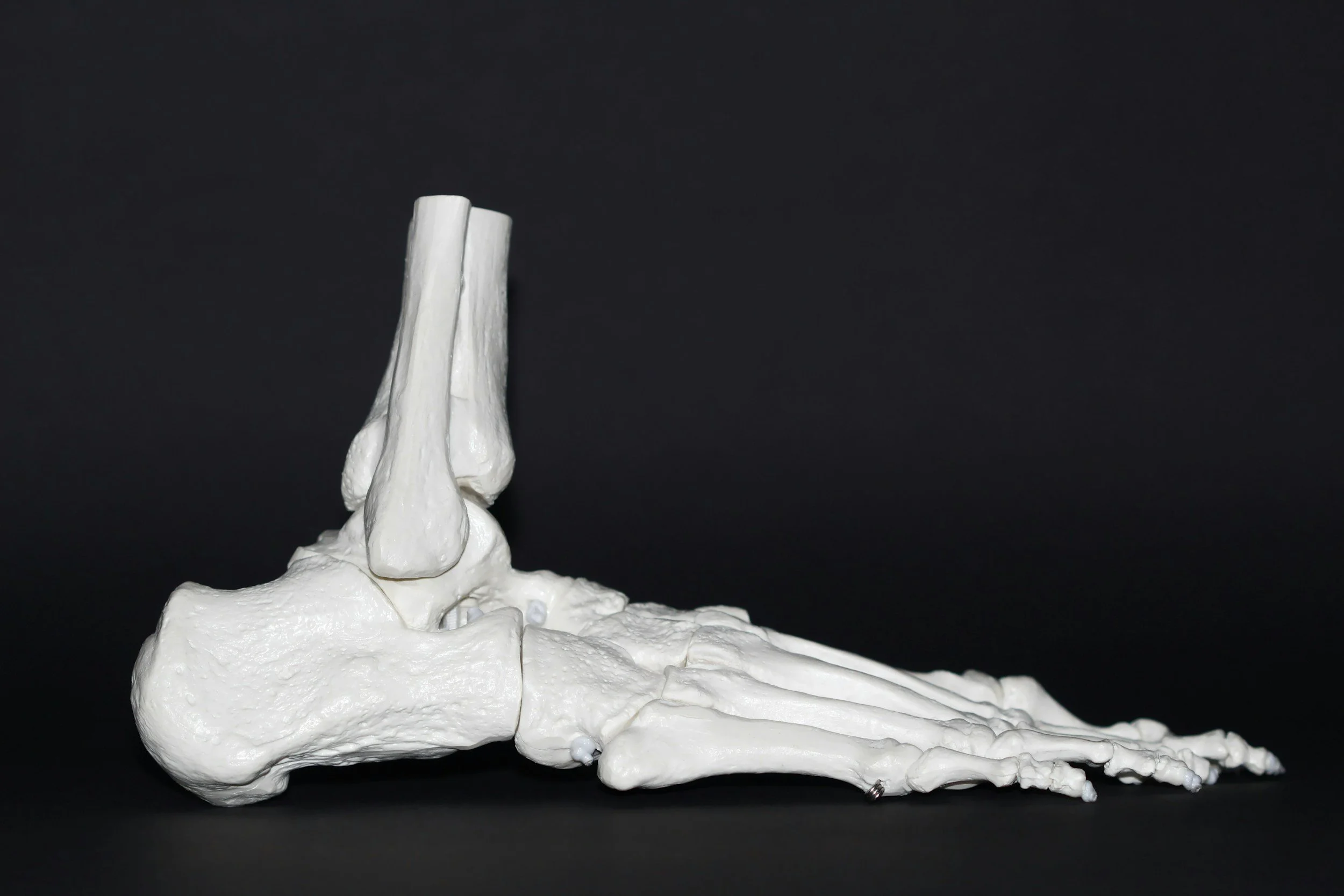 White anatomical model of a human ankle bone with tendons and ligaments on a black background.