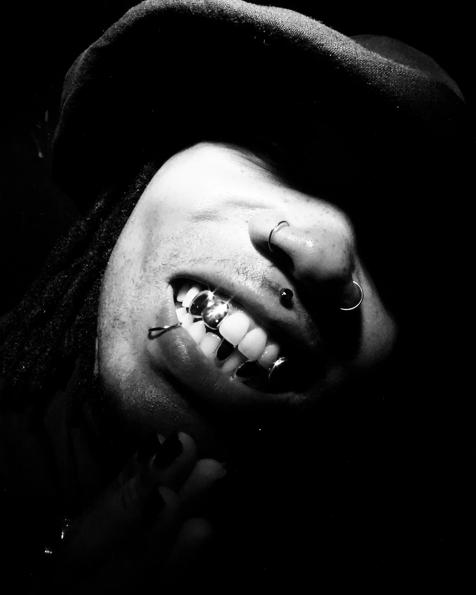 Custom grillz Sydney — handcrafted made to order