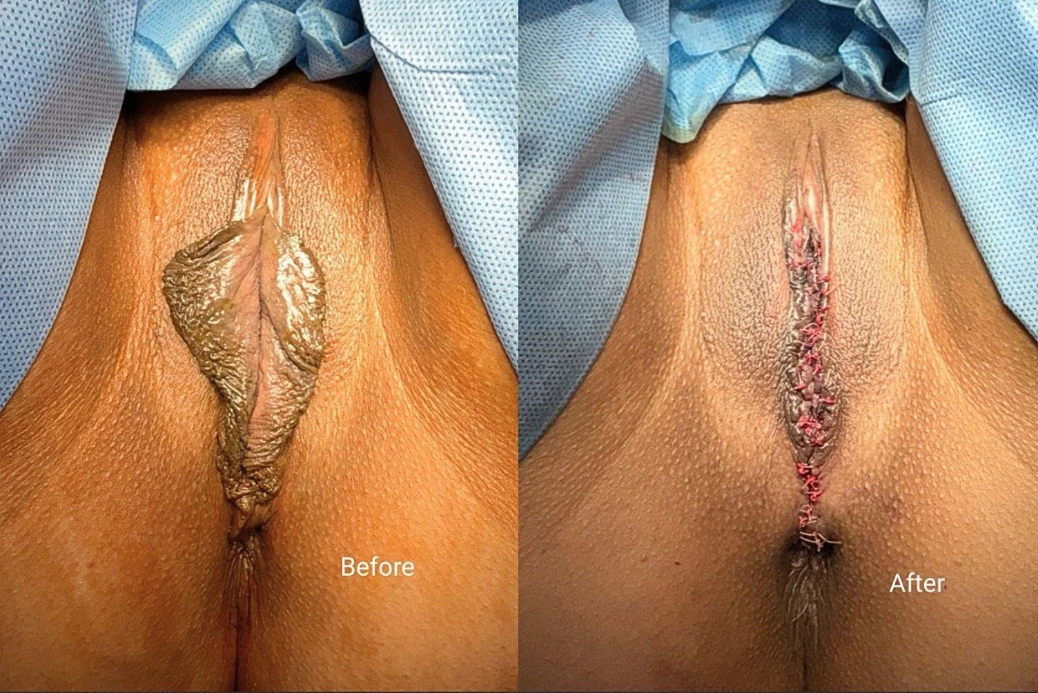 vaginoplasty-surgeon-houston-Medical Spa_Sugar Land.jpeg