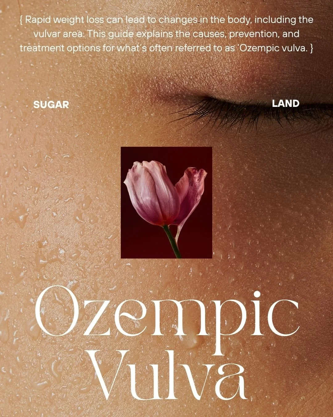 What Is “Ozempic Vulva”? Causes, Prevention &amp; Treatment Options
