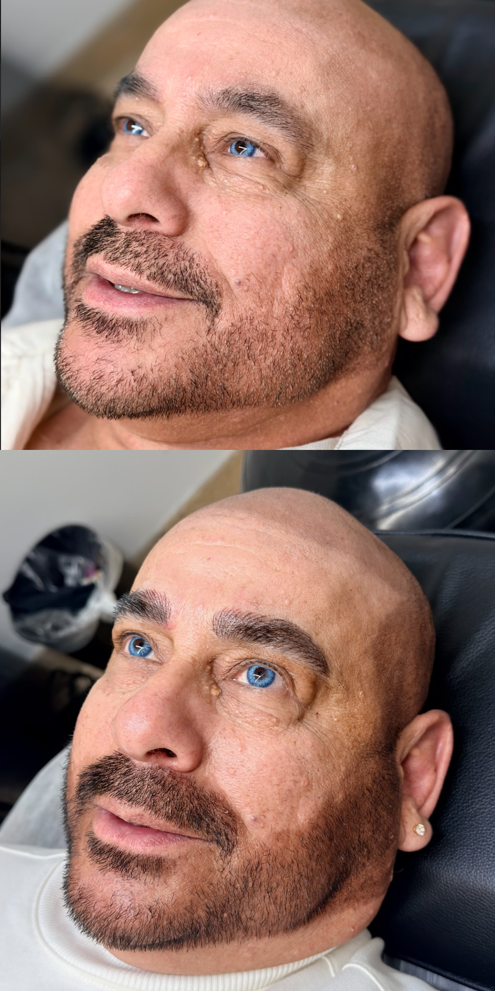 Before and after photo of male with permanent makeup treatment.