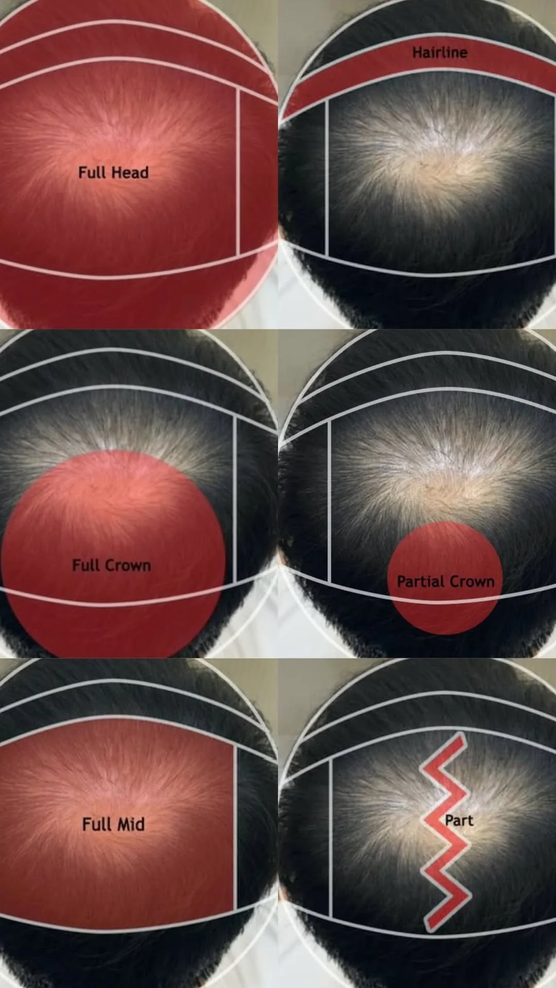 Treatment areas with thinning hair or hair loss for MoriTint treatment in Los Angeles (LA). Images of different scalp types showing hair density patterns, labeled as full head, hairline, full crown, partial crown, full mid, and part.